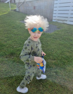 BOY WITH UNCOMBABLE HAIR SYNDROME