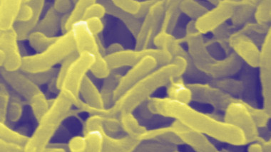 Scanning electron micrograph of Cholera bacteria