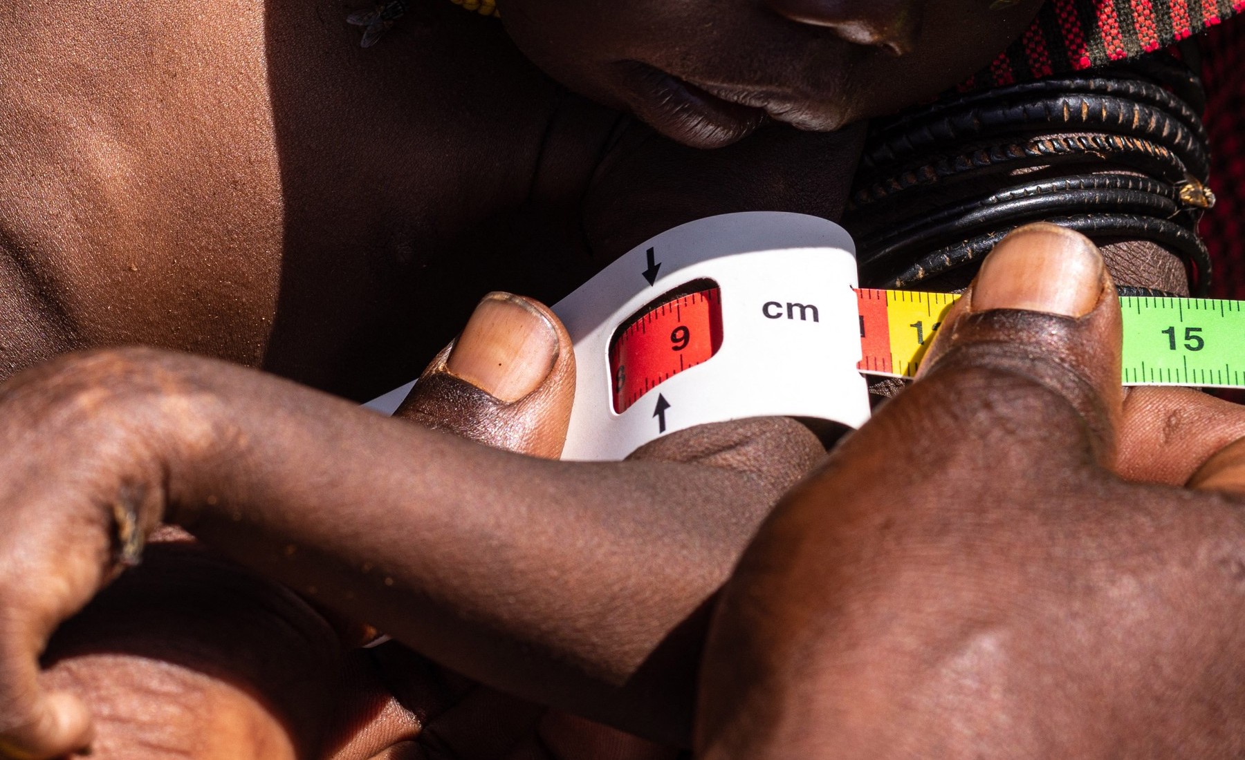 Uganda raportează „decese cauzate de foamete”