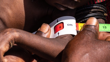 A boy's circumference of his arm is measured during a nutrition screening in Lomusian, Karamoja region, Uganda