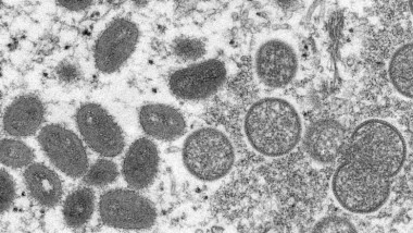 Virusul variolei maimuței văzut la microscop.