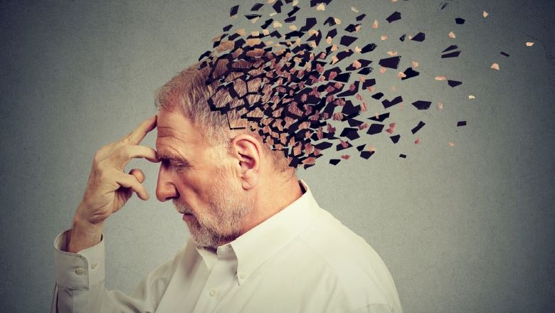 Rolul imagisticii prin rezonanță magnetică în diagnosticul bolii Alzheimer