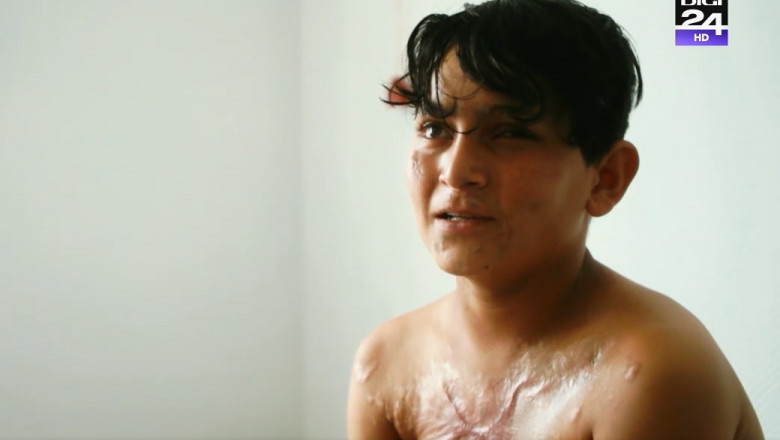 abdul copil afgan ranit de o bomba