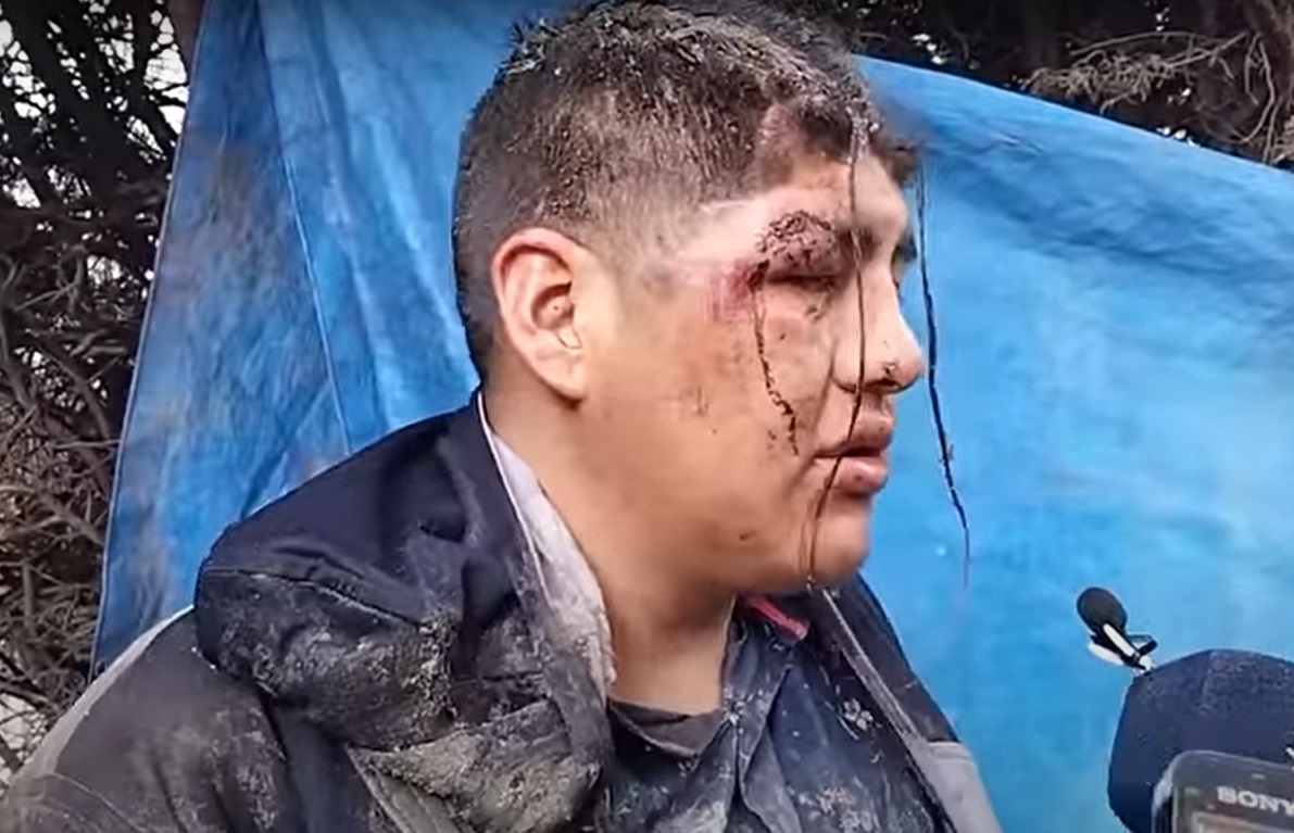 Un bărbat din Bolivia spune că a fost îngropat de viu și și-a dat seama abia când a vrut să meargă la baie. Imaginile au devenit virale