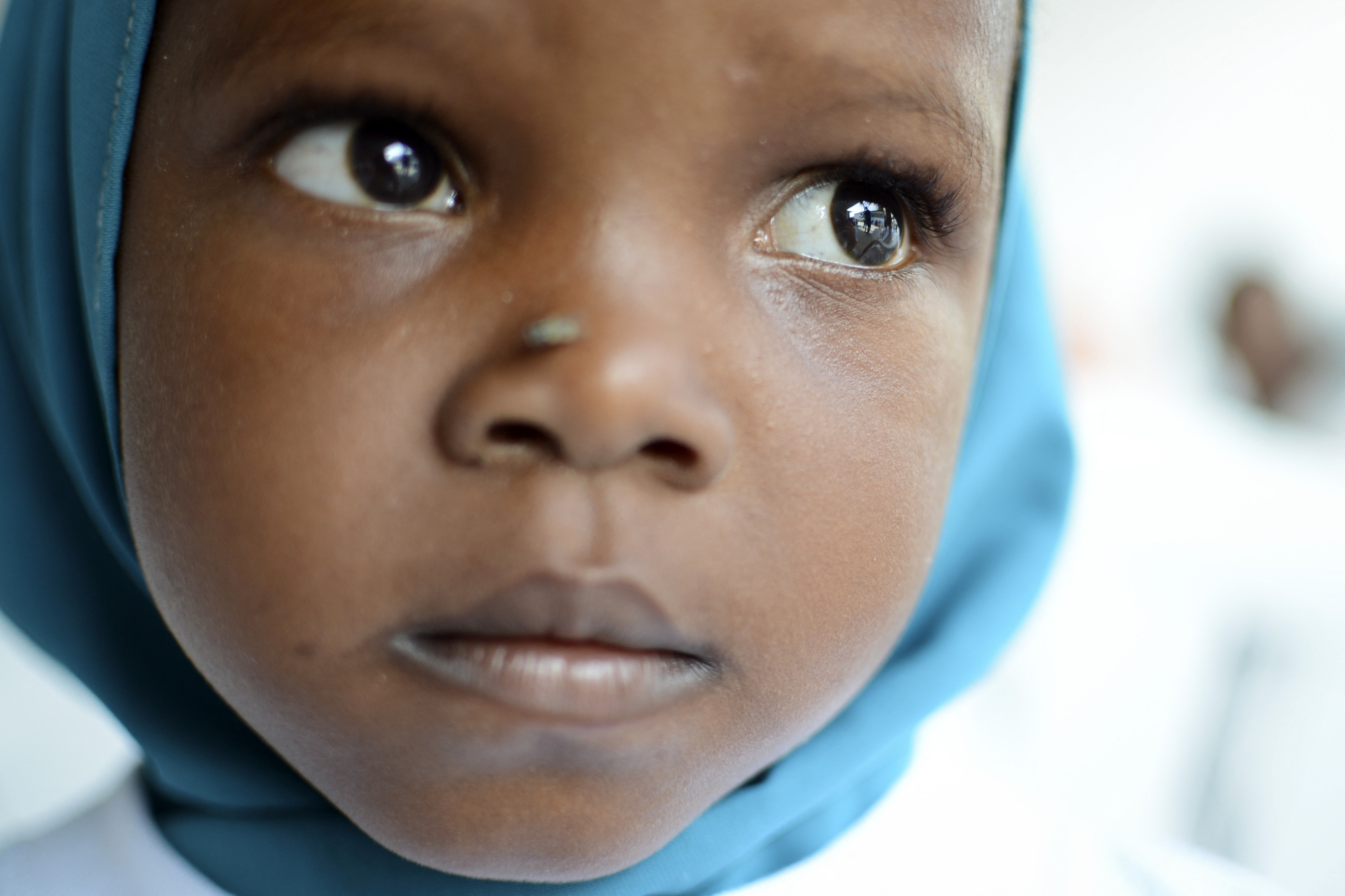 UNICEF: Peste 700 de copii au murit în centrele de nutriţie din Somalia