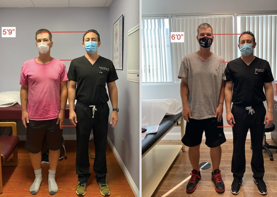 Tot mai mulți bărbați plătesc sute de mii de euro pentru ca doctorii să le rupă picioarele, în speranța că vor pleca acasă mai înalți
