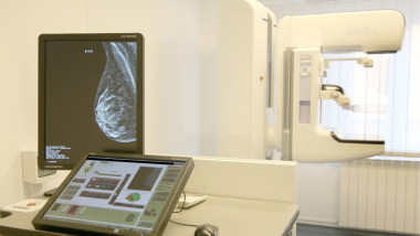 Mamografie SANADOR