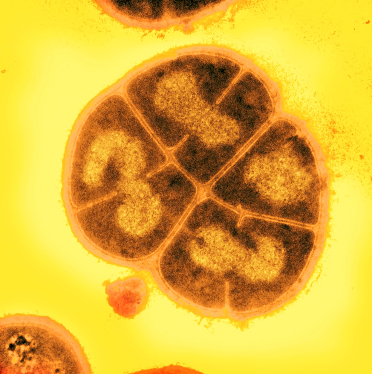 Microbii ar fi putut rezista sute de milioane de ani sub suprafața planetei Marte. Cazul supraviețuitorului "Conan Bacteria"