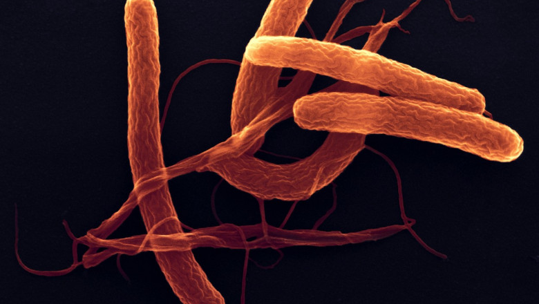 Bacterii de holeră căzute la microscop