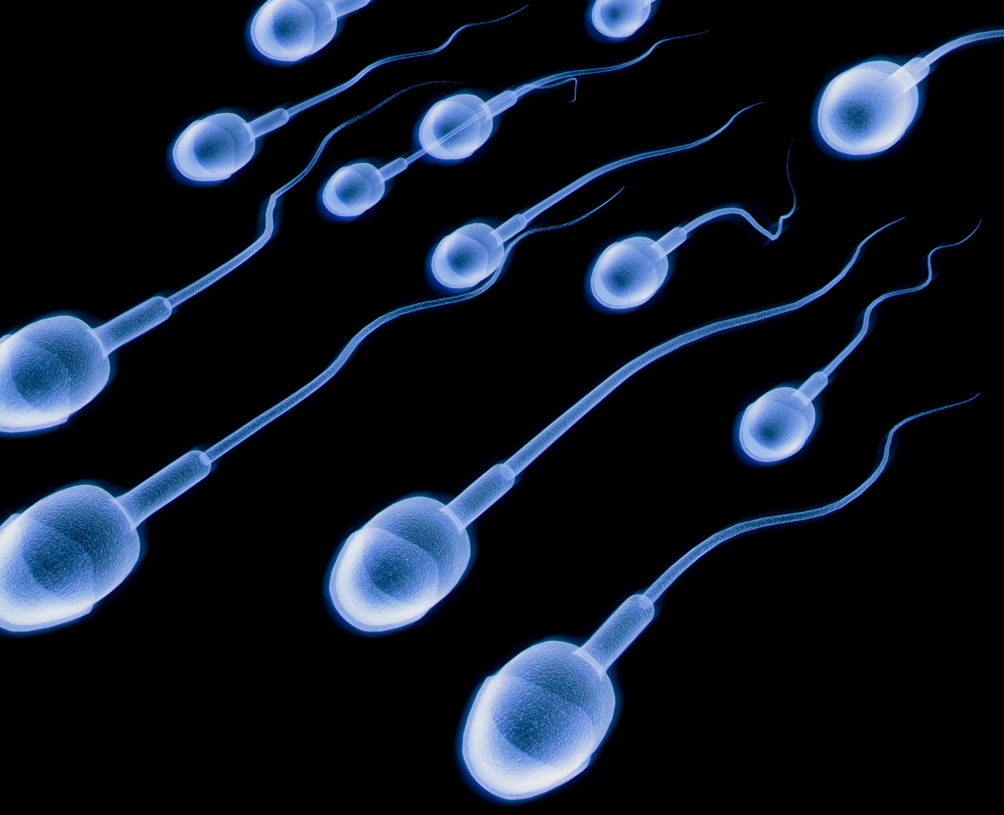 Omenirea s-ar putea confrunta cu o criză a fertilității: concentrația materialului seminal a scăzut la jumătate în ultimii 40 de ani