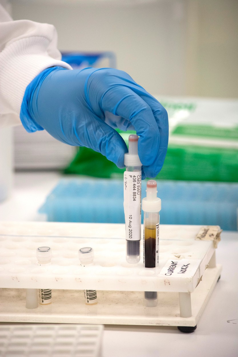 Colesterolul "bun" ar putea fi doar un mit. Un studiu zdruncină una din recomandările medicale din ultimele decenii