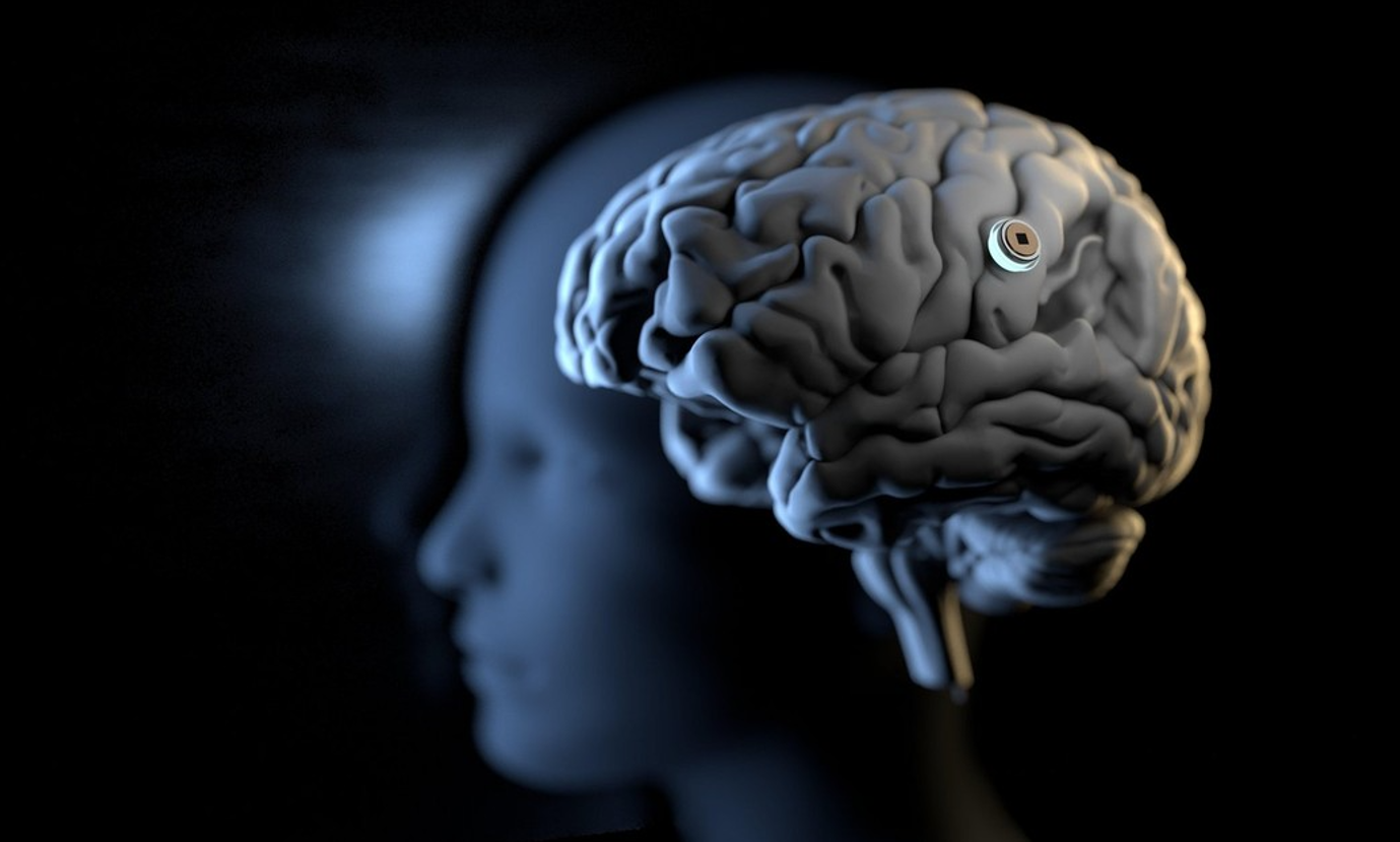 Neuralink spune ca in şase luni va putea realiza implanturi conectate in creierul uman