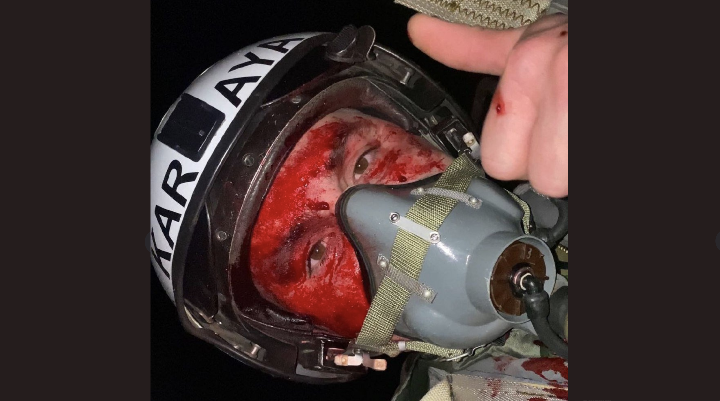 Povestea incredibilă a eroului ucrainean care și-a făcut selfie după ce s-a catapultat din avionul avariat: Nimeni nu ne poate distruge