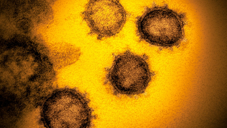 Virusul Sars-Cov-2 văzut la microscop