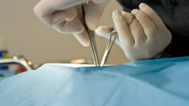 chirurg operatie