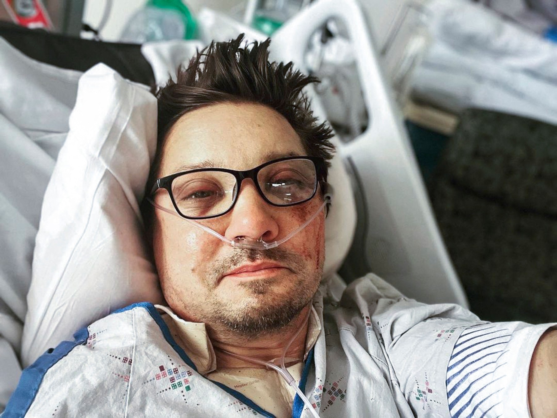 Jeremy Renner și-a rupt peste 30 de oase în accidentul cu plugul de zăpadă. Cum se recuperează actorul