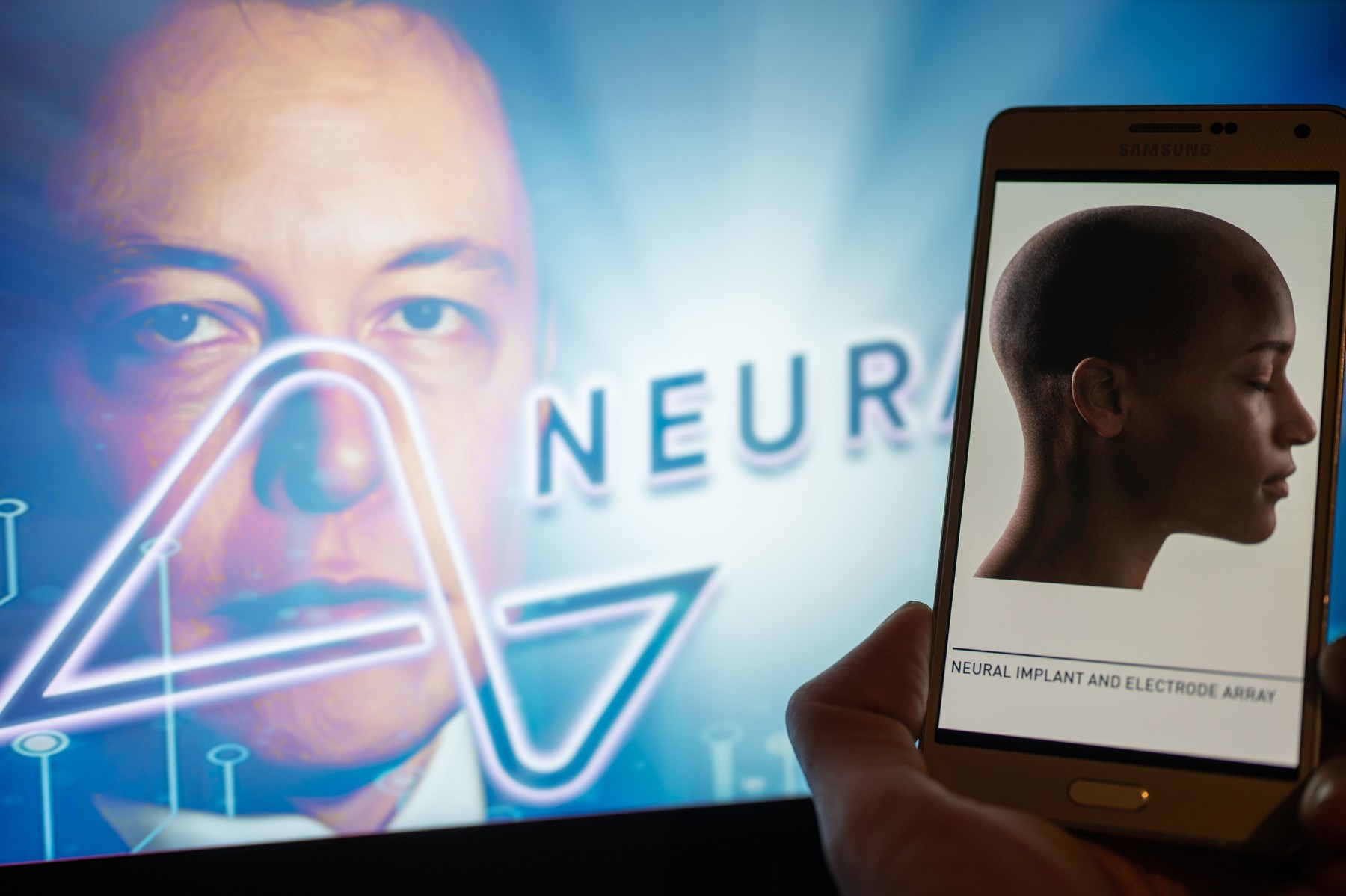 Cipurile pe care Musk vrea să ni le implanteze în creier ne pot afecta personalitatea. „Au existat tentative de sinucidere”