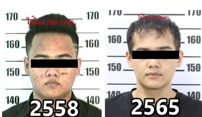 Un bărbat din Thailanda dat în urmărire internațională și-a făcut mai multe operații estetice ca să arate ca un coreean