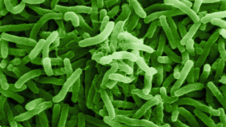 imagine cu bacteria care provoacă holeră