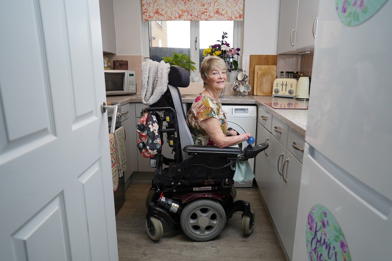 O femeie care vrea să aibă din nou mâini a refuzat transplantul de două ori pentru că nu-și dorește mâini de bărbat sau de culoare
