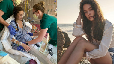 Supermodelul Claire Bridges, înainte și după îmbolnăvirea cu Covid-19