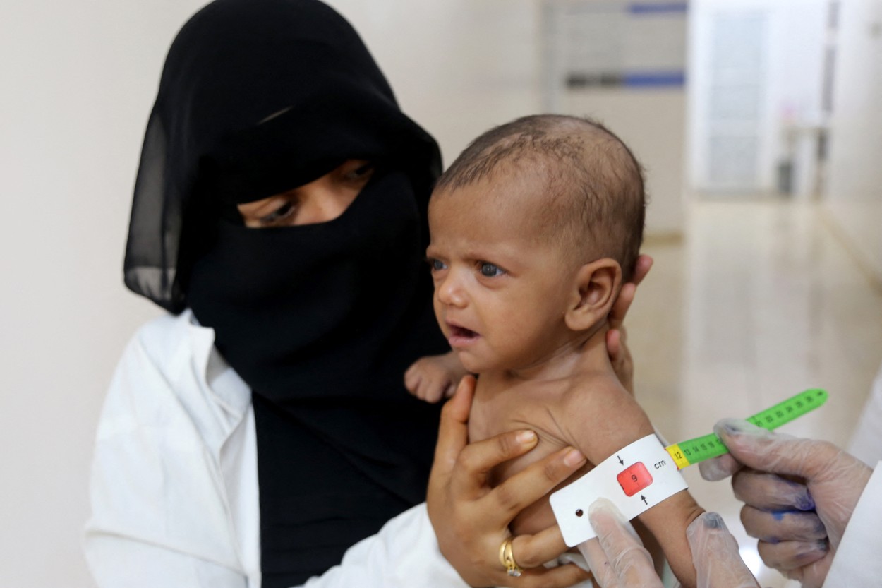 Un copil moare la fiecare 10 minute în Yemen. UNICEF cere ajutor urgent după ce țările donatoare au promis doar 25% din banii necesari