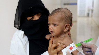 copil masurat yemen