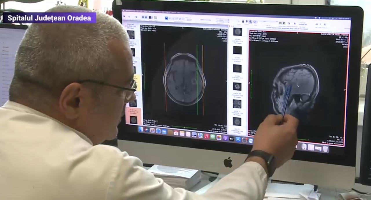 VIDEO Un bărbat de 66 de ani din Oradea a stat de vorbă cu medicii, în timp ce aceștia îl operau pe creier