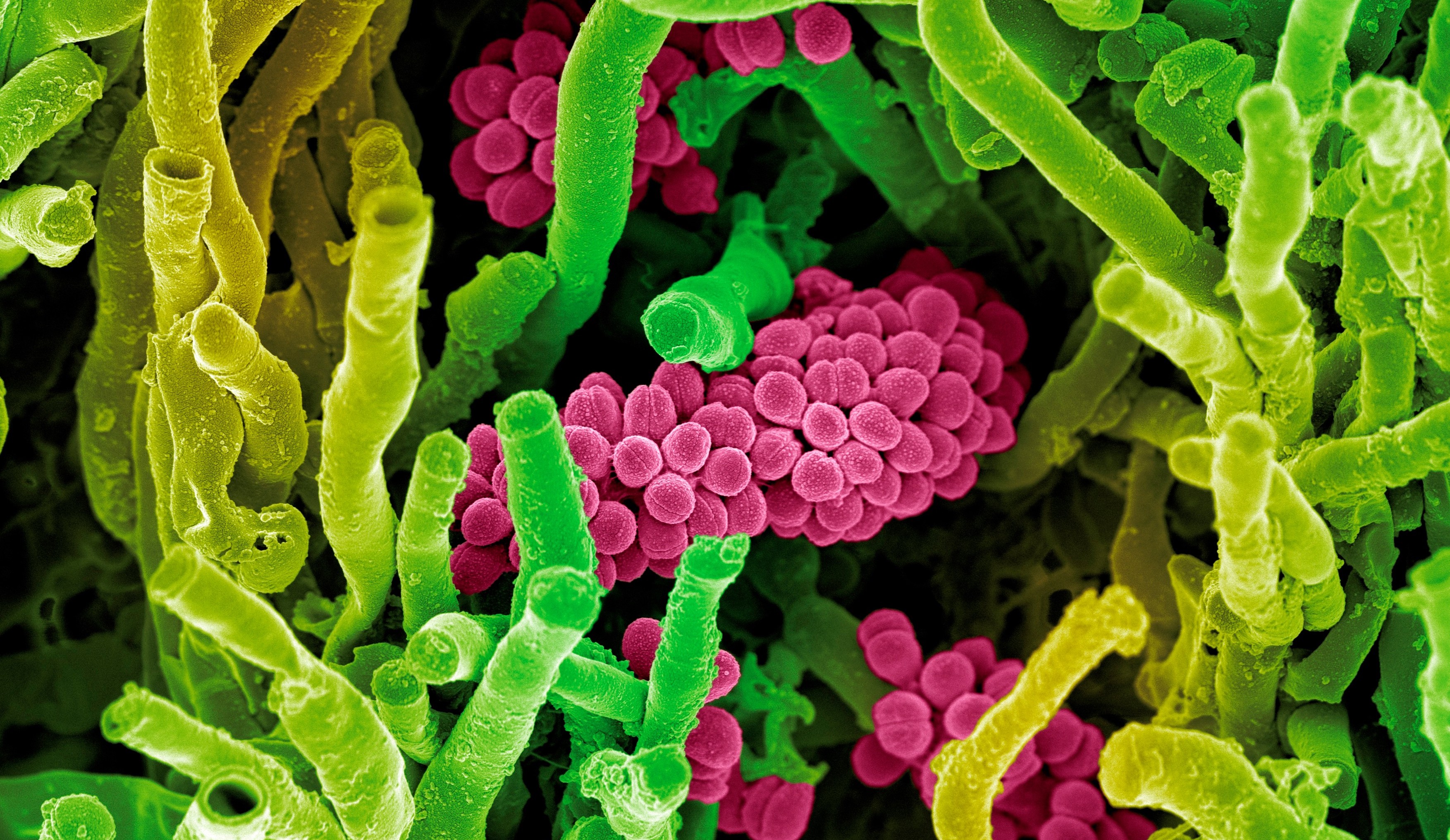 O proteină din sistemul nostru imunitar ar putea ajuta la combaterea bacteriei „mâncătoare de carne” (studiu)