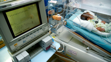 bebeluș prematur într-un incubator
