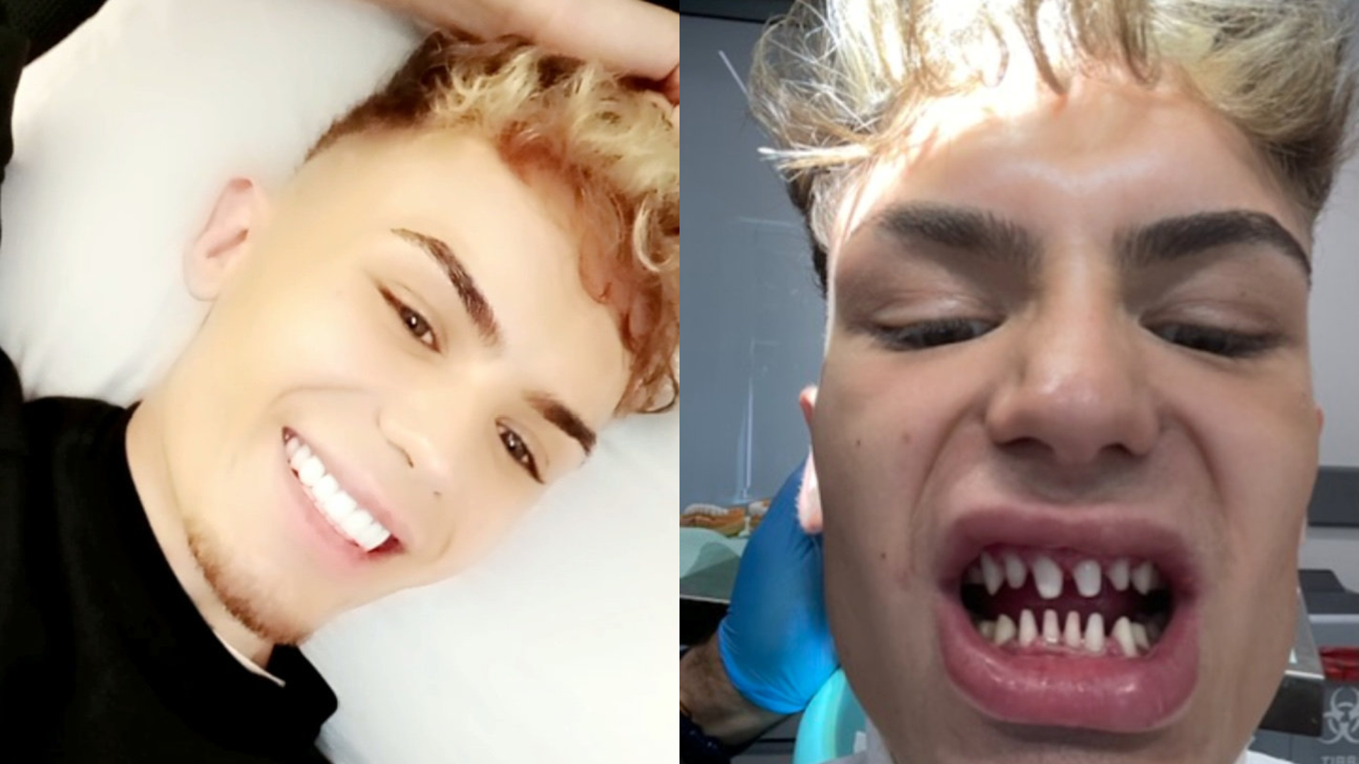Un tânăr de 22 de ani se plânge că arată „ca un rechin” după ce s-a dus la dentist, în Turcia