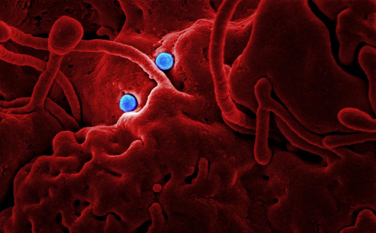 Un bărbat din Emiratele Arabe Unite a fost diagnosticat cu coronavirusul MERS-Cov (OMS)