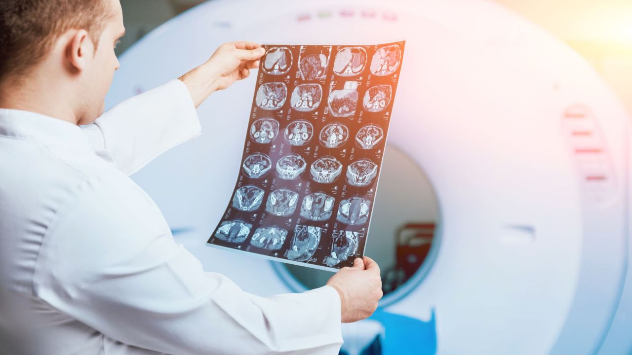 Centrele de imagistică REGINA MARIA: O radiografie a investigațiilor efectuate de români în 2022