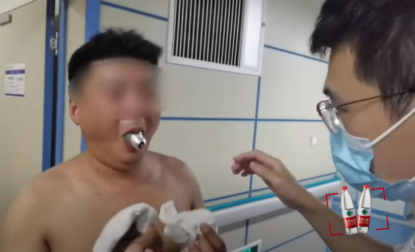 VIDEO. Un bărbat a ajuns la urgențe cu un bec blocat în gură, după ce a văzut o provocare online și s-a gândit să o încerce și el