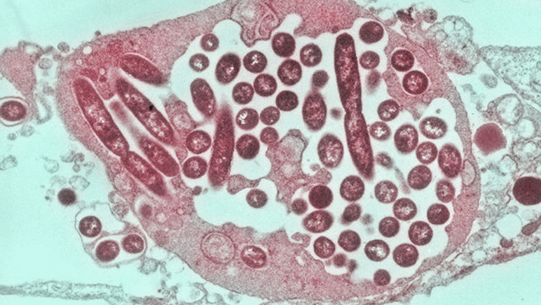 legionella vazuta la microscop