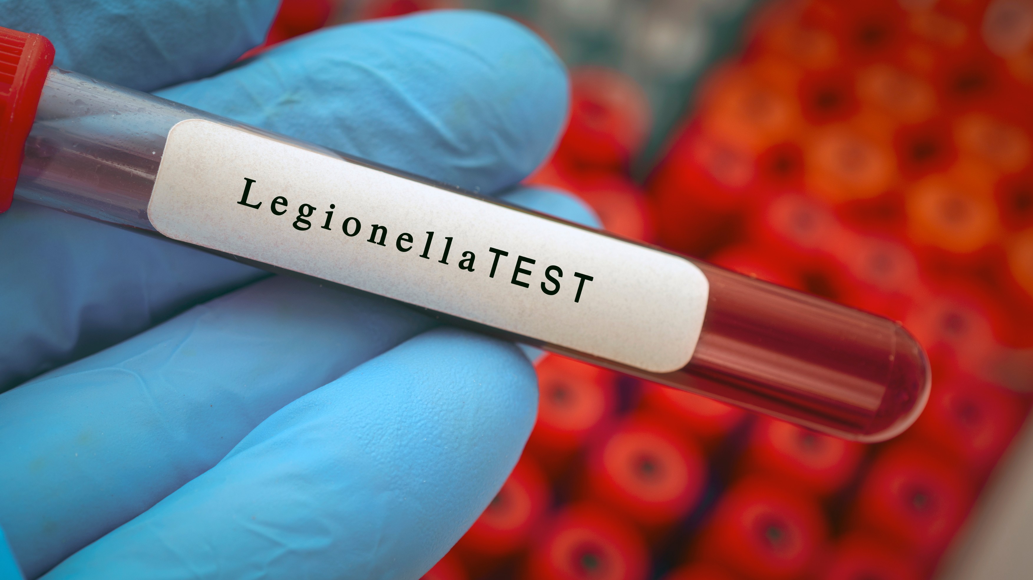 Boala legionarilor ar fi putut veni de la ruși. Polonia investighează "implicarea" Rusiei în răspândirea bacteriei Legionella