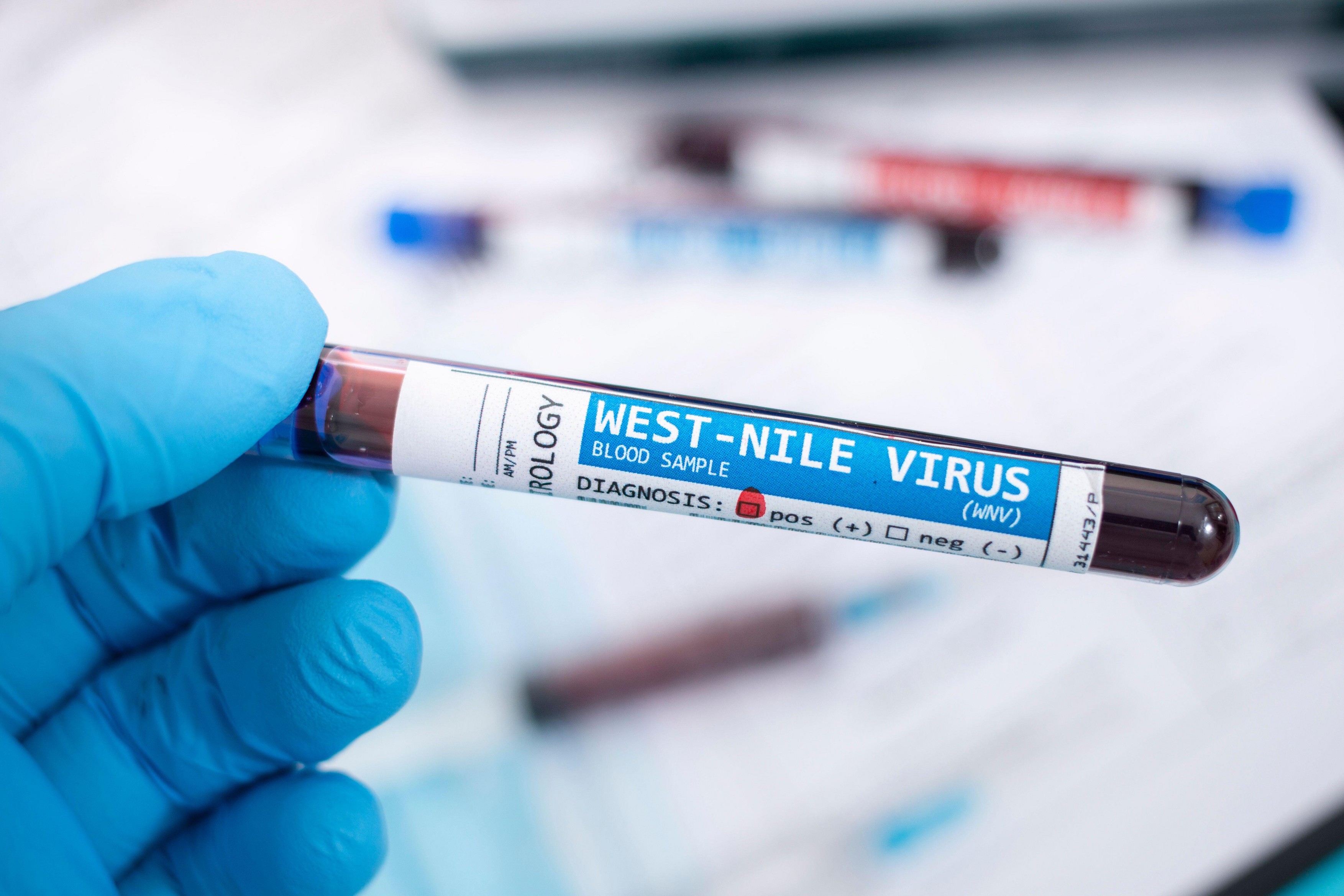 Restricții la donarea de sânge în județele cu cazuri confirmate de West Nile. Ce trebuie să știe donatorii