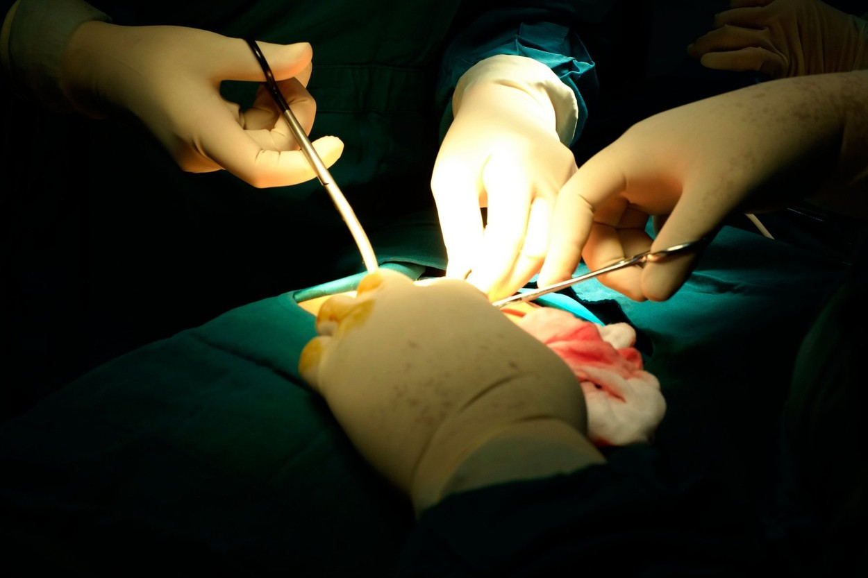 Un bărbat a încercat să obțină 650 de milioane de dolari de la un spital pentru că medicii l-au lăsat să vadă cezariana soției