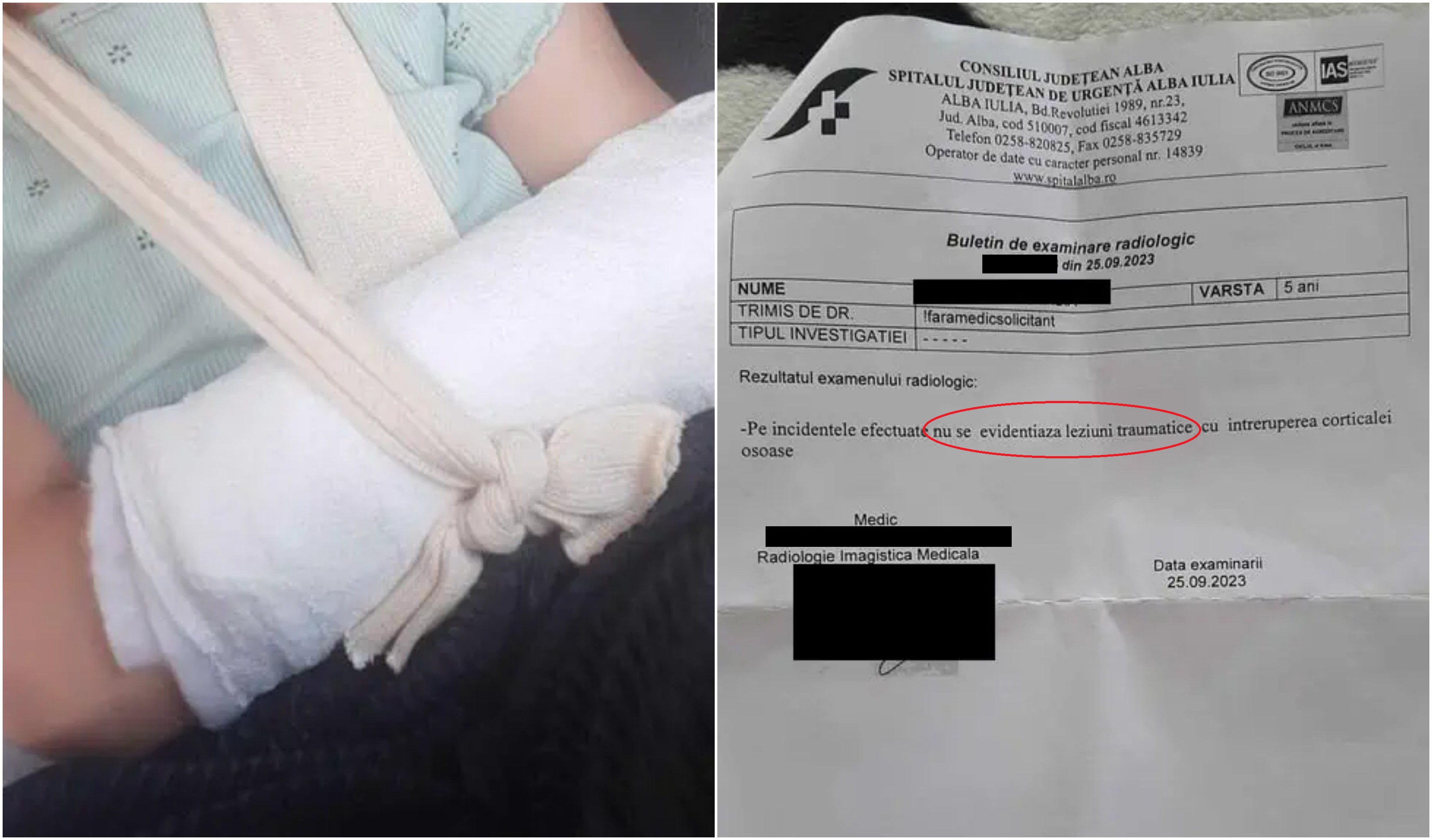 O fetiță de 5 ani a ajuns la spital cu mâna ruptă. Medicii din Alba nu și-ar fi dat seama și i-au recomandat unguent pentru durere