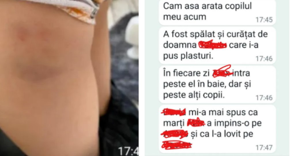 Copii de 6 ani, terorizați de un coleg la o școală din Brașov. Cei mici au ajuns acasă cu vânătăi. Poliția face verificări