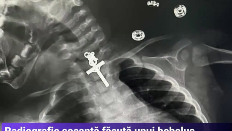 radiografie care arata un crucifix