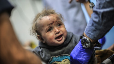 copil rănit în Gaza