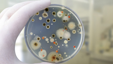 Românii se expun, fără să-și dea seama, la bacterii extrem de periculoase