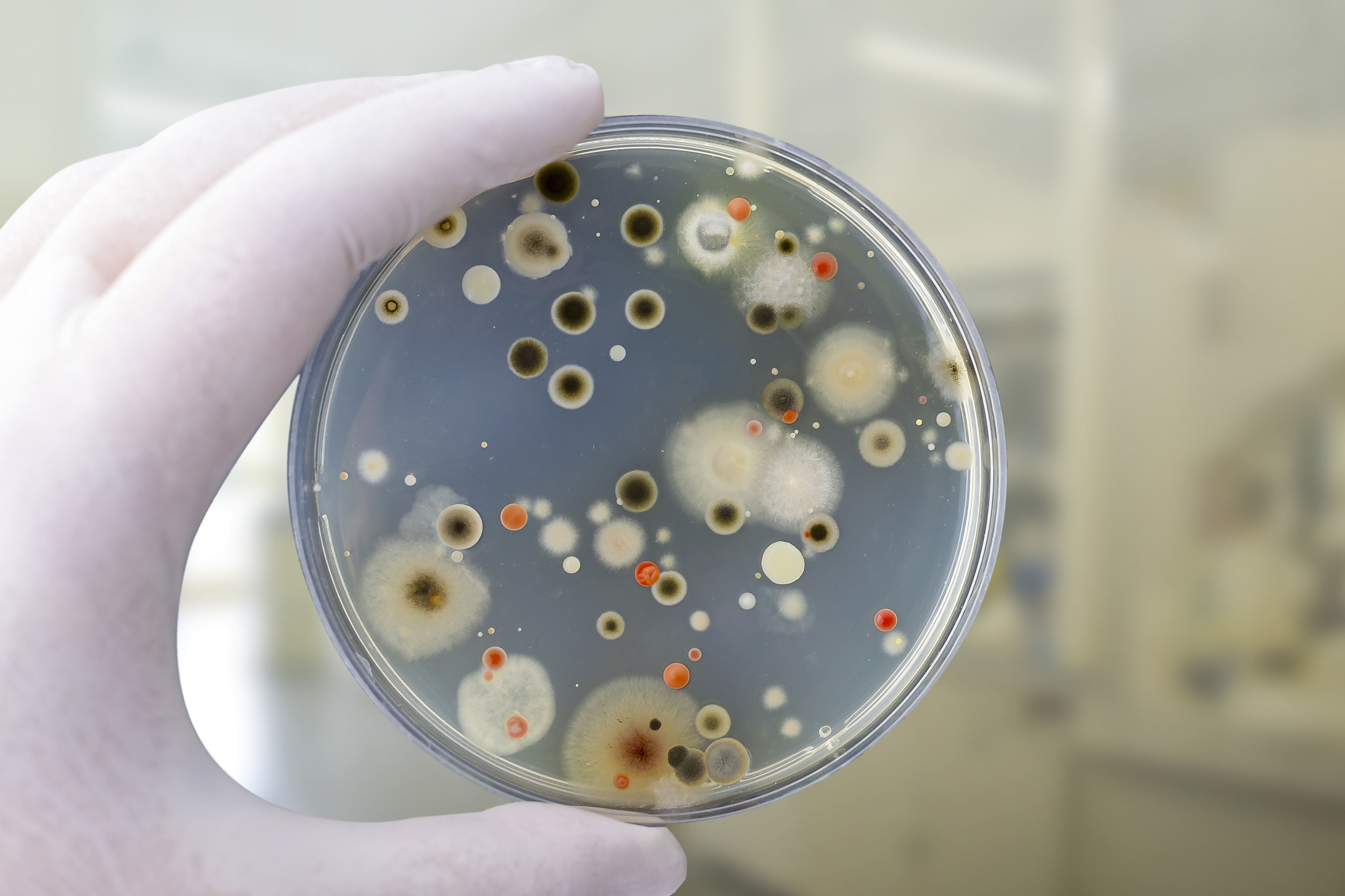 Experiment Digi24. Oamenii se expun la bacterii periculoase, fără să-și dea seama. Greșelile pe care le facem