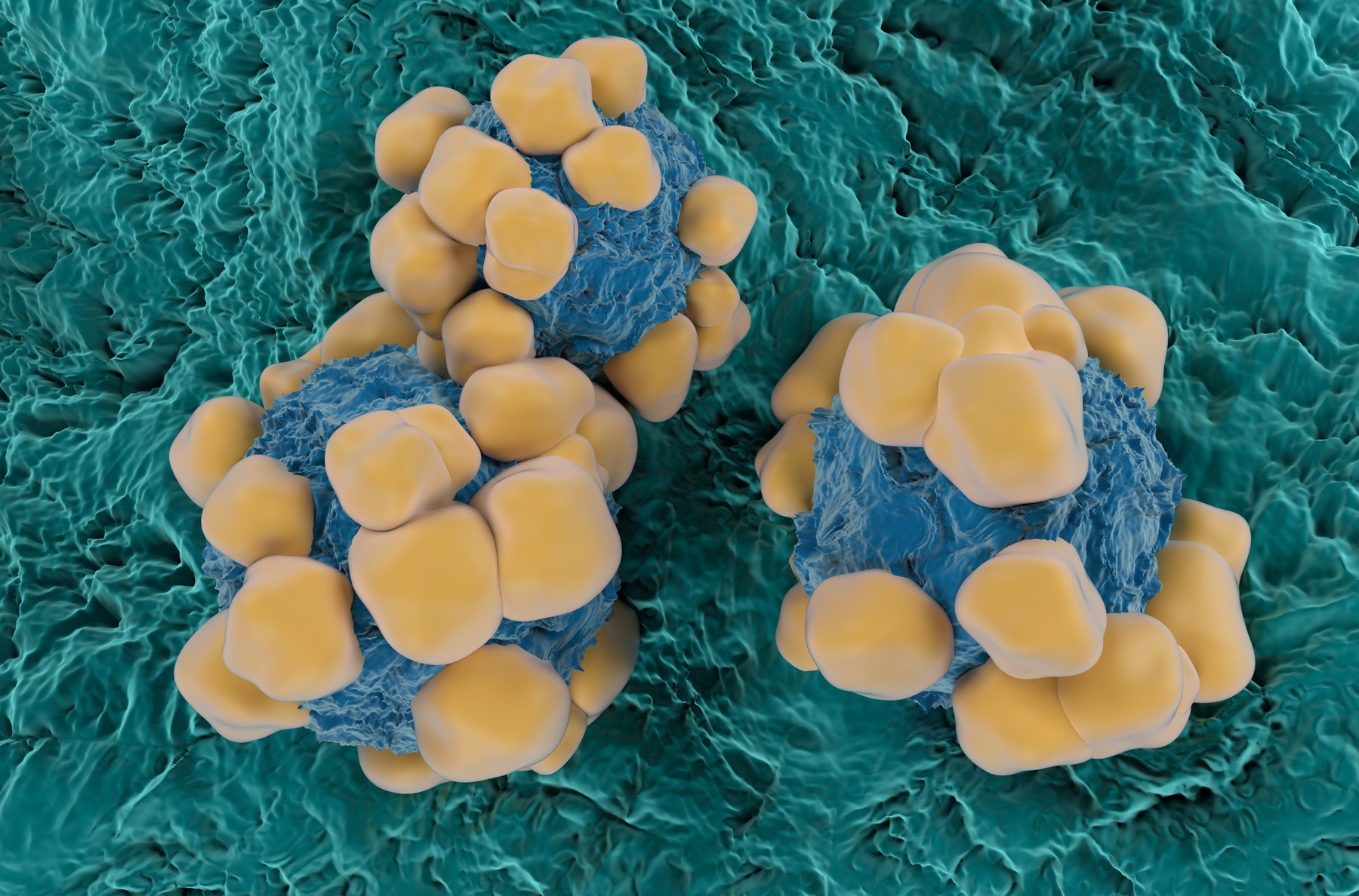 O noua metoda de distrugere a tumorilor canceroase, descoperita de cercetatorii israelieni. Cum actioneaza