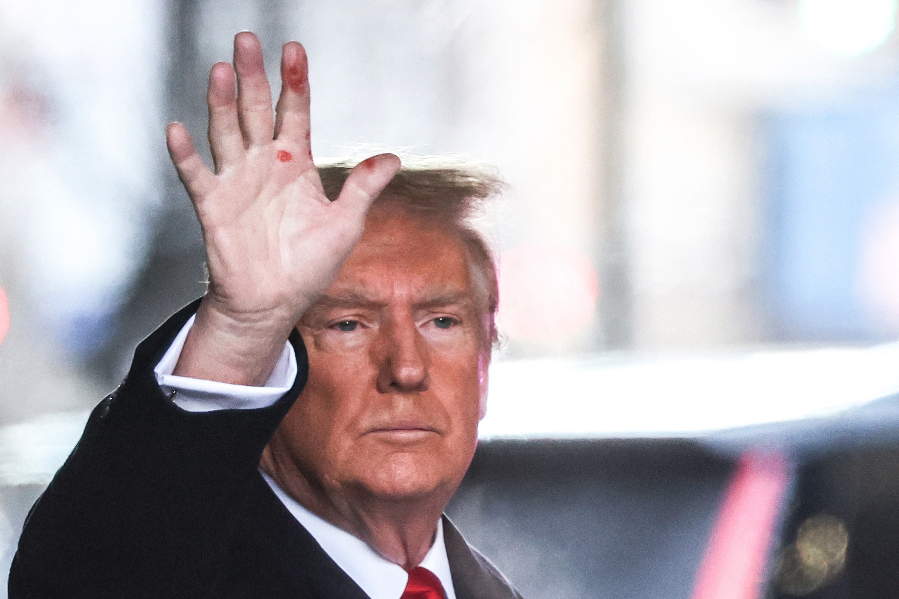 Rănile misterioase de pe mâna lui Trump. Un expert în dermatologie a explicat ce ar putea fi