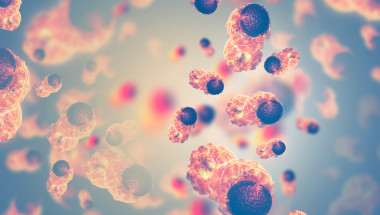 celule canceroase in organism vazute la microscop