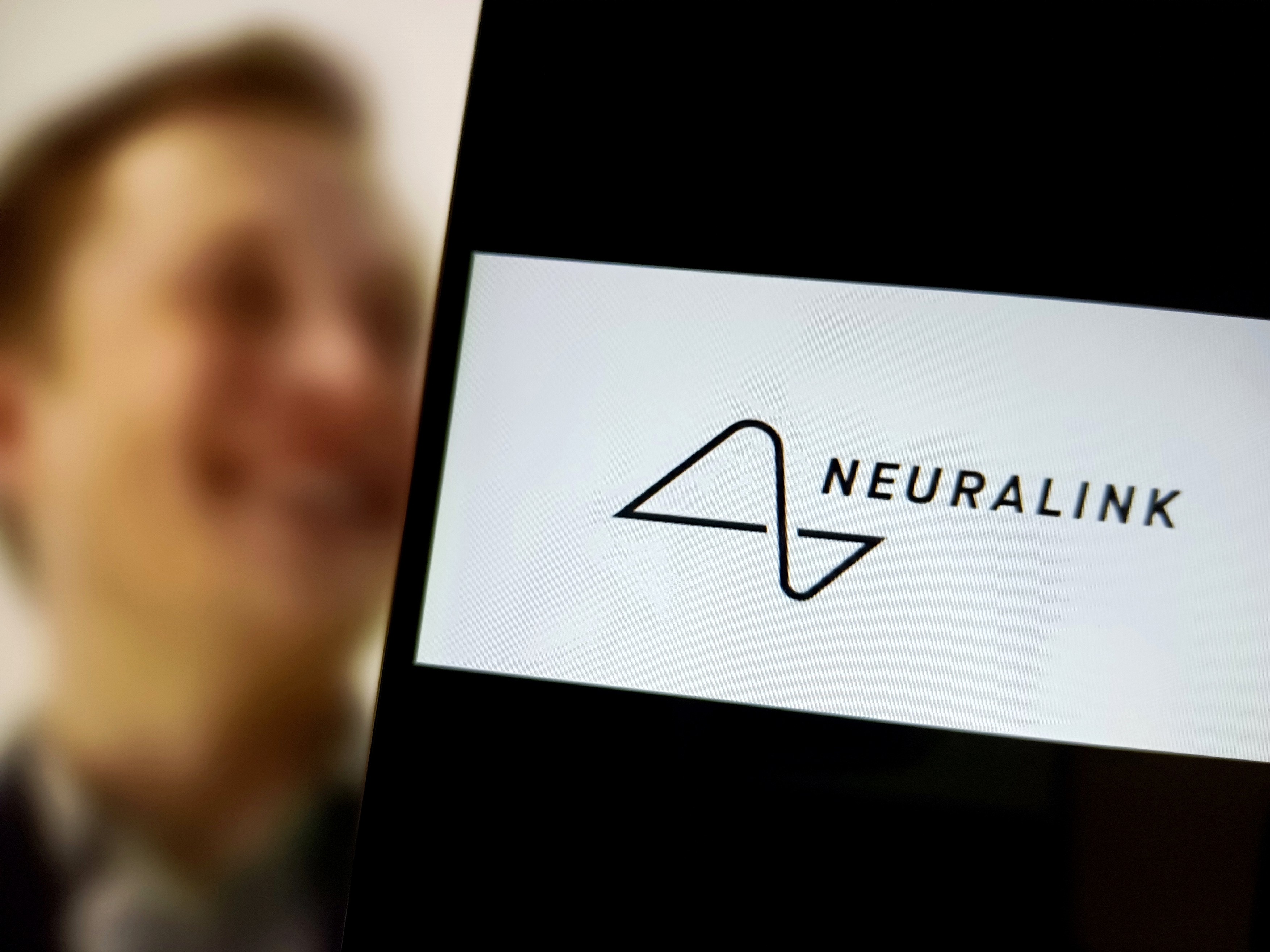 Elon Musk a anunţat că Neuralink a realizat primul său implant cerebral