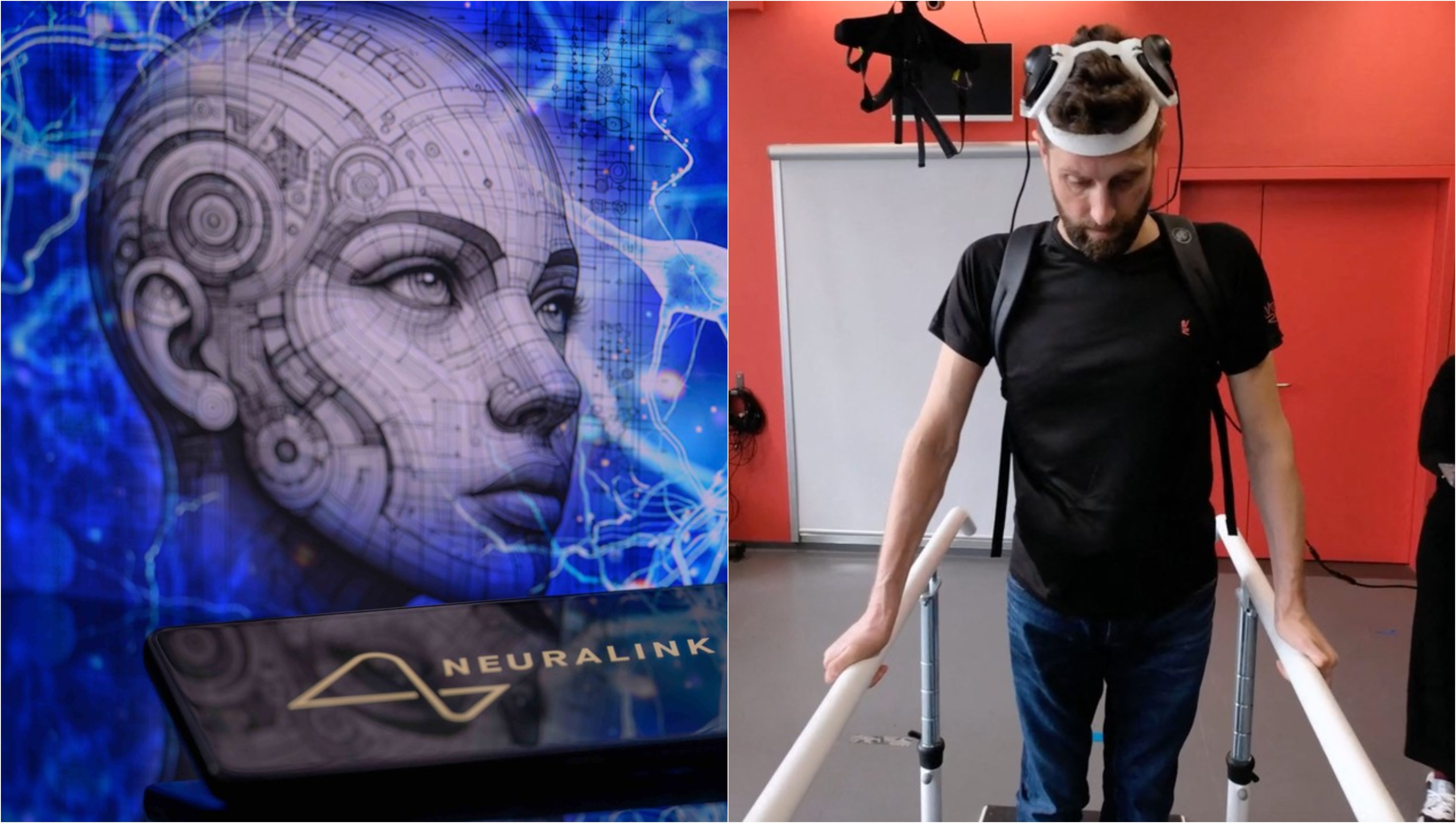 Tehnologia cipurilor implantate în creier a lui Elon Musk anunță începutul erei cyborgilor