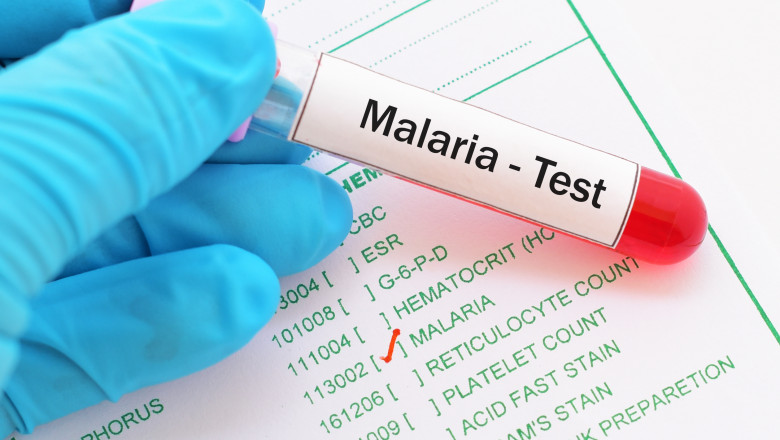 test malarie